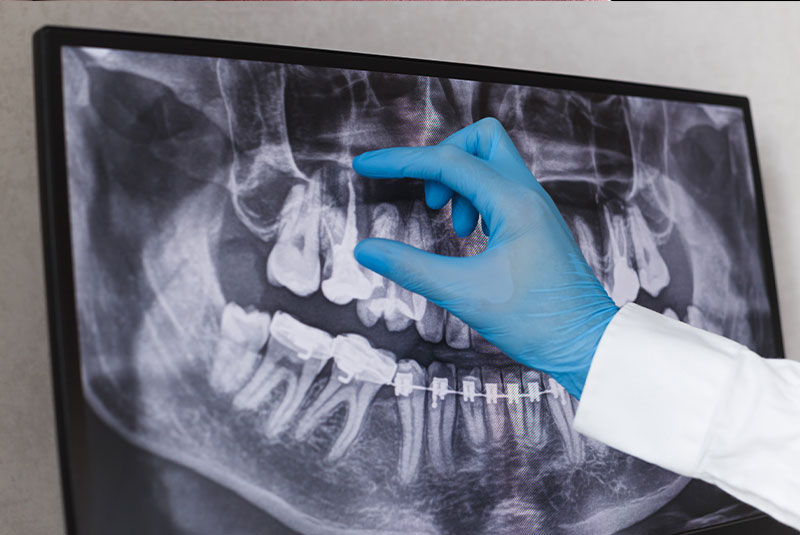 close up of doctor examining dental x ray for dental procedure